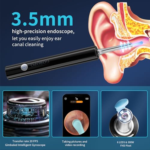 Ear Wax Removal Kit with HD Camera and 6 LED Lights W14376