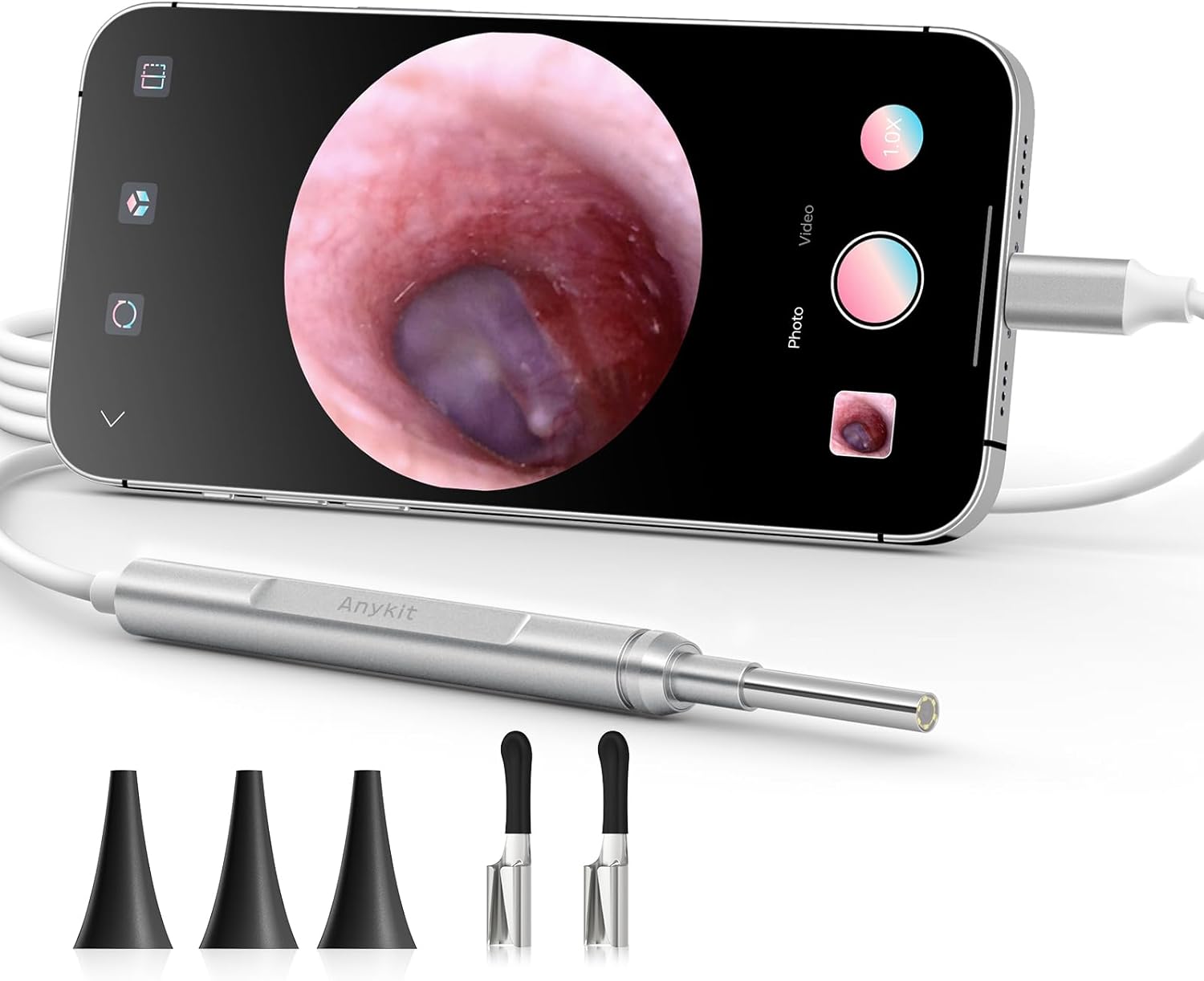 Anykit Ear Wax Removal Tool, Ultra Clear View Ear Scope with LED Lights for Ear Cleaning, Ear Cleaner Camera Otoscope with Ear Spoon & Specula for Phone & Tablet