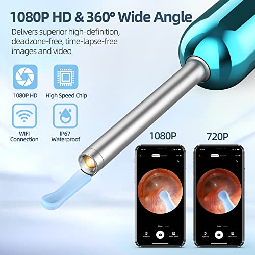 Ear Wax Removal Kit with 1080P Camera and Light for Phones O4947