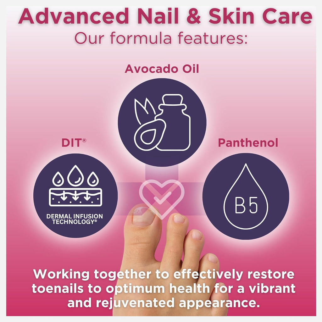 Anti-Fungal Toe Tincture Spray, 1.7 Fl Oz N28773