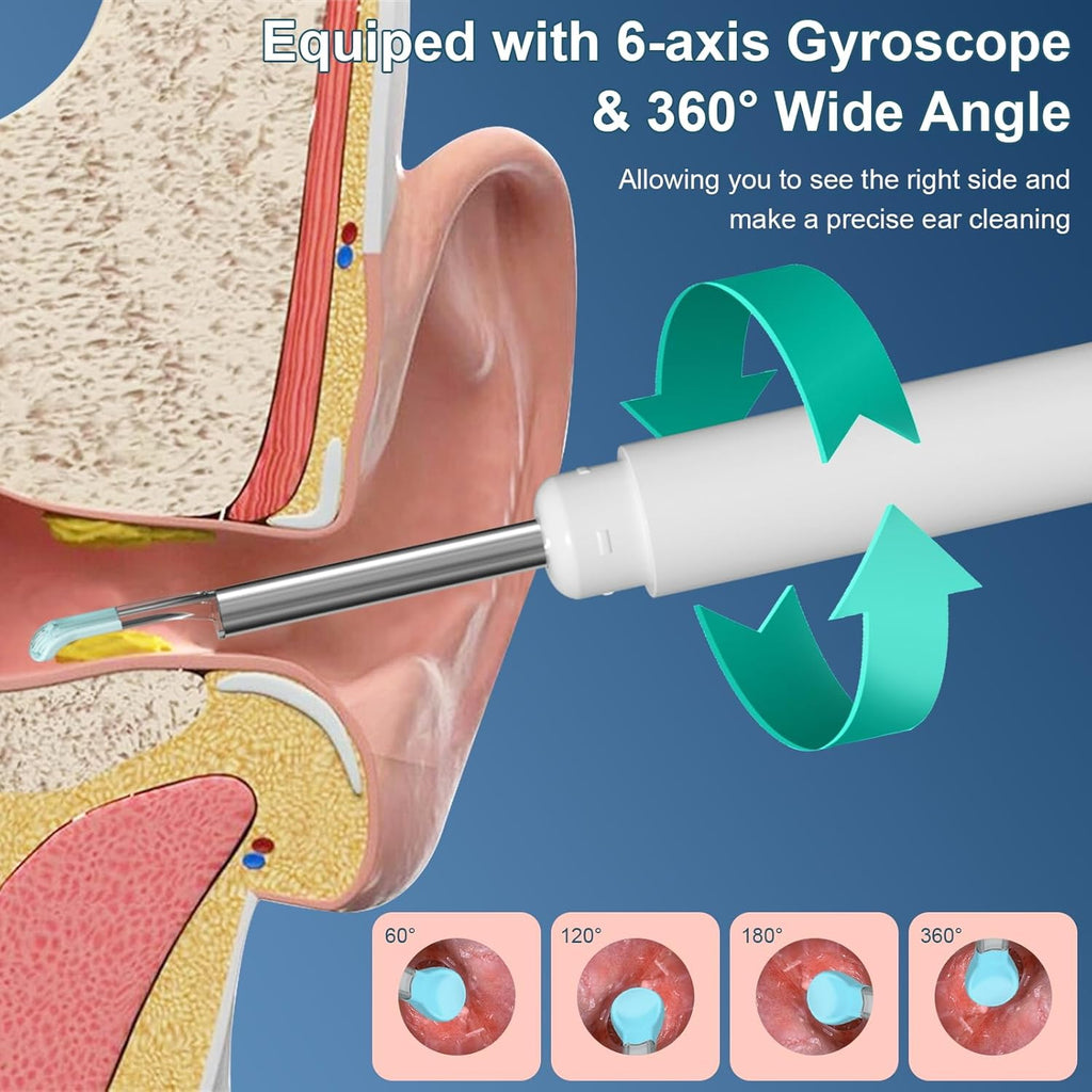 Ear Wax Removal Tool with 1080P HD Camera and 12 Replacement Tips A22729