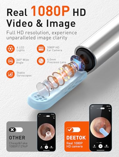 Ear Wax Removal Kit with 1080P Camera and Light H84951