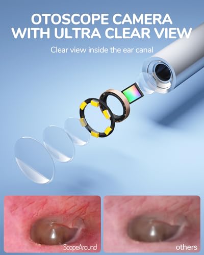 Otoscope Ear Camera with 4.5" IPS Screen, FHD Visual Ear Cleaner with Light G22735