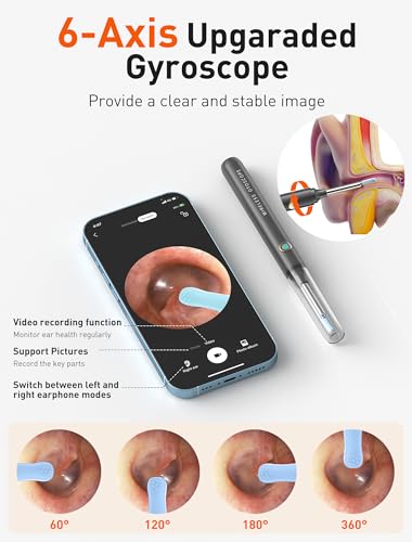 Ear Wax Removal Kit with 1080P Camera and Light H84951
