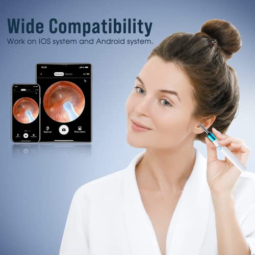 Ear Wax Removal Kit with 1080P Camera and Light for Phones O4947