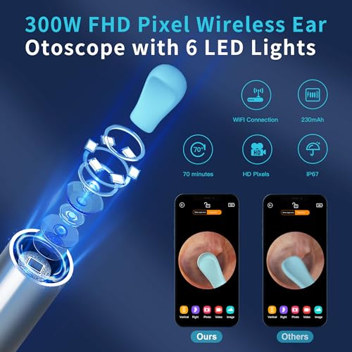 Ear Wax Removal Kit with HD Camera and 6 LED Lights W14376