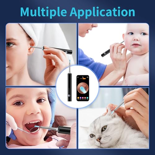 Ear Wax Removal Kit with HD Camera and 6 LED Lights W14376