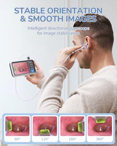 Otoscope Ear Camera with 4.5" IPS Screen, FHD Visual Ear Cleaner with Light G22735
