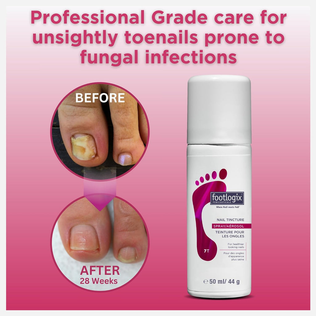 Anti-Fungal Toe Tincture Spray, 1.7 Fl Oz N28773