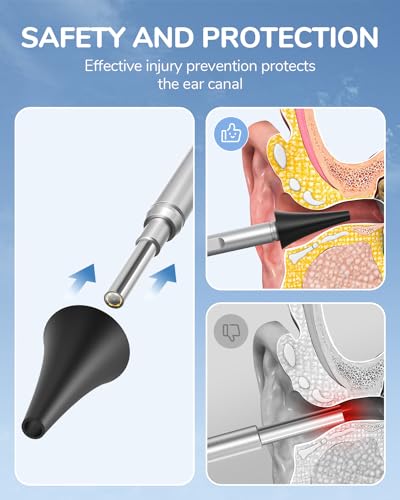 Otoscope Ear Camera with 4.5" IPS Screen, FHD Visual Ear Cleaner with Light G22735