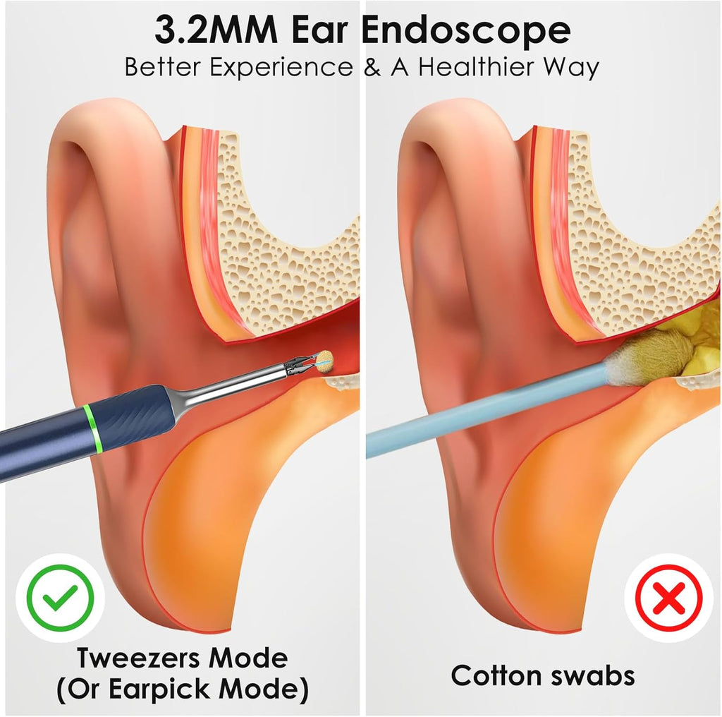 Ear Wax Removal Tool Camera with Ear Pick, Tweezers & 12 Ear Spoons K449515