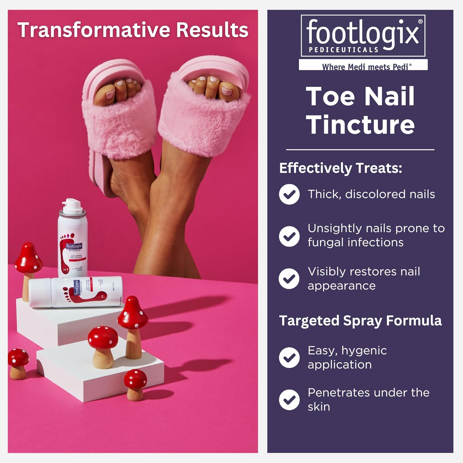 Anti-Fungal Toe Tincture Spray, 1.7 Fl Oz N28773