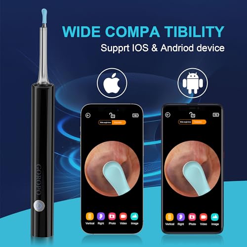 Ear Wax Removal Kit with HD Camera and 6 LED Lights W14376