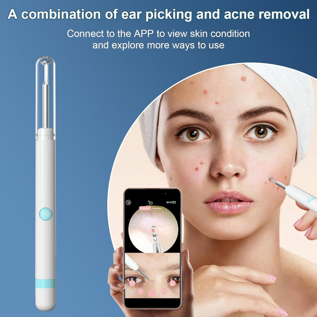 Ear Wax Removal Tool with 1080P HD Camera and 12 Replacement Tips A22729