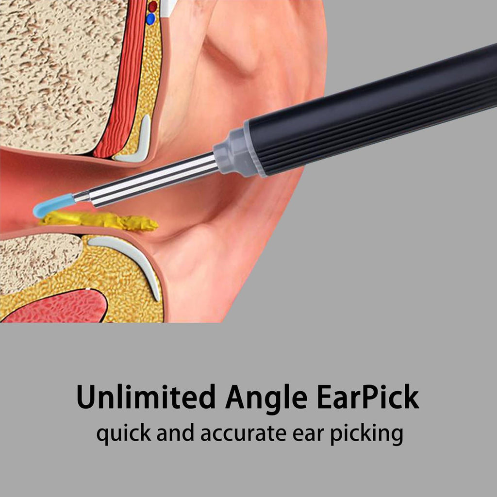 Ear Wax Removal Cleaner with 1080P HD Camera Otoscope for iPhone, iPad & Android D114071