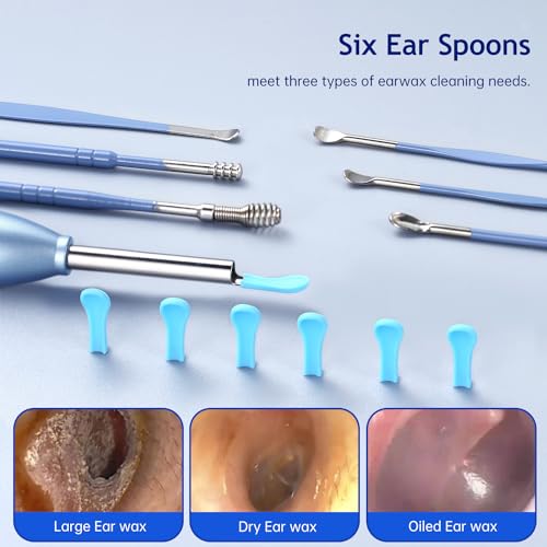 Ear Wax Removal Tool with HD Camera and LED Lights C753